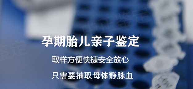 南京胎儿亲子鉴定如何办理,南京孕期亲子鉴定结果准吗