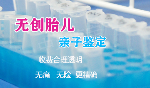 南京胎儿亲子鉴定如何办理,南京孕期亲子鉴定结果准吗