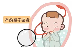 南京产前亲子鉴定怎么做检测咨询
